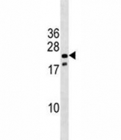 Nkx3.1 antibody western blot analysis in mouse stomach tissue lysate. Predicted molecular weight ~28 kDa, observed at 28-38 kDa.