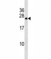 BNIP1 antibody western blot analysis in MCF-7 lysate. Predicted molecular weight: ~26kDa.