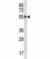 Cyclin A antibody western blot analysis in mouse kidney tissue lysate. Predicted molecular weight: 50-55 kDa