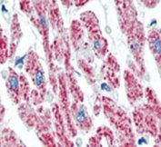 IHC analysis of FFPE human heart tissue stained with Aconitase 2 antibody.