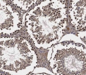 IHC staining of FFPE mouse testis with Lats2 antibody. HIER: boil tissue sections in pH 9 10mM Tris with 1mM EDTA for 20 min and allow to cool before testing.