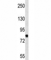 Dyrk1a antibody western blot analysis in NCI-H460 lysate. Predicted molecular weight ~85 kDa.
