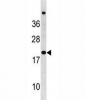 CDKN2A antibody western blot analysis in ZR-75-1 lysate