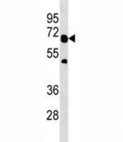 TRAF6 antibody western blot analysis in A549 lysate. Predicted molecular weight: ~64 kDa