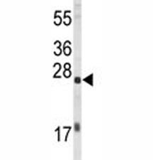 Western blot analysis of EIF4E antibody and HL-60 lysate. Predicted molecular weight ~27 kDa.