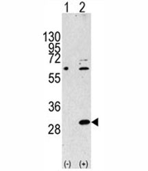Western blot analysis of EIF4E2 antibody and 293 cell lysate either nontransfected (Lane 1) or transiently transfected with the EIF4E