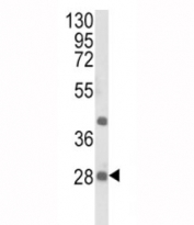 Western blot analysis of EIF4E2 antibody and NCI-H460 lysate. Predicted molecular weight: ~28 kDa.