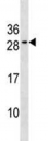 Bcl-2 antibody western blot analysis in MDA-MB453 lysate