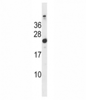 Hras1 antibody western blot analysis in mouse bladder tissue lysate. Predicted molecular weight ~ 21 kDa.