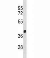 Arg1 antibody western blot analysis in rat liver tissue lysate. Predicted molecular weight ~35kDa.