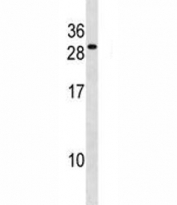 FADD antibody western blot analysis in WiDr lysate