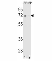 Western blot analysis of ER antibody pre-incubated without (Lane 1) and with (2) blocking peptide in K562 lysate. Predicted molecular weight: 65-70 kDa.~