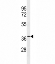 Estrogen Receptor antibody (isoform 4) western blot analysis in MCF-7 lysate. Predicted molecular weight: 36 kDa.