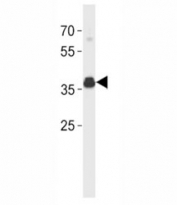ER antibody (isoform 4) western blot analysis in SK-BR-3 lysate. Predicted molecular weight: 36 kDa.
