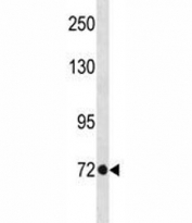 TBR2 antibody western blot analysis in A375 lysate. Observed molecular weight: 73-85 kDa.