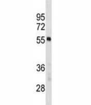PTBP1 antibody western blot analysis in MCF-7 lysate. Predicted molecular weight ~57kDa.