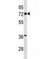 Estrogen Receptor antibody western blot analysis in mouse NIH3T3 lysate