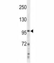 NFKB2 antibody western blot analysis in NCI-H460 lysate. Predicted molecular weight ~100 kDa.