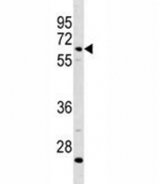 C8B antibody western blot analysis in CEM lysate