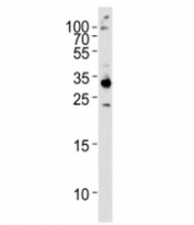 Western blot analysis of HeLa lysate and RPS6 antibody used at 1:1000. Predicted molecular weight ~29 kDa.