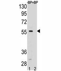 SMAD5 antibody pre-incubated without (lane 1) and with (2) blocking peptide in HeLa lysate. Observed molecular weight: 52~60 kDa.