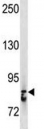 STAT3 antibody western blot analysis in A375 lysate. Predicted/observed molecular weight ~88kDa.
