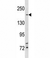 TSC2 antibody western blot analysis in NCI-H292 lysate. Predicted molecular weight ~200 kDa.