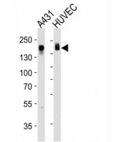 Western blot analysis of lysate from A431, HUVEC cell line (left to right) using Epidermal Growth Factor Receptor antibody; Ab was diluted at 1:1000 for each lane. Expected molecular weight: ~134/170 kDa (unmodified/glycosylated).