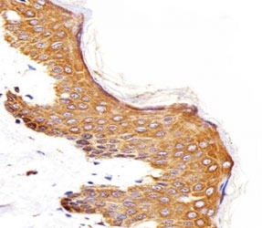 IHC analysis of FFPE human skin section using Epidermal Growth Factor Receptor antibody; Ab was diluted at 1:25.~