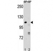 PARP1 antibody pre-incubated without (lane 1) and with (2) blocking peptide in NCI-H292 lysate