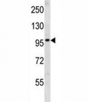Progesterone Receptor antibody western blot analysis in human CEM lysate. Expected molecular weight: 82-94 kDa (PR-A) and 99-120 kDa (PR-B).