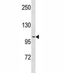 PR antibody western blot analysis in ZR-75-1 lysate. Predicted molecular weight ~99 kDa.