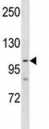 PARP 1 antibody western blot analysis in NCI-H460 lysate.