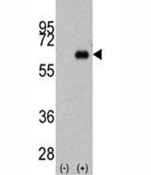 Western blot analysis of anti-Myc antibody and 293 cell lysate (2 ug/lane) either nontransfected (Lane 1) or transiently transfected with the MYC gene (2).~