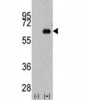 Western blot analysis of anti-Myc antibody and 293 cell lysate (2 ug/lane) either nontransfected (Lane 1) or transiently transfected with the MYC gene (2).