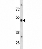 CXCR5 antibody western blot analysis in K562 lysate. Predicted molecular weight ~43 kDa.