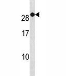 RAB7B antibody western blot analysis in A2058 lysate.