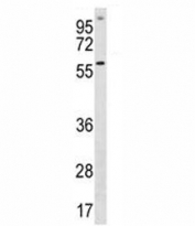 ETV5 antibody western blot analysis in A549 lysate