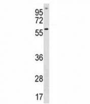 ETV5 antibody western blot analysis in A549 lysate