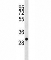 SDHB antibody western blot analysis in 293 lysate. Predicted molecular weight ~32kDa.