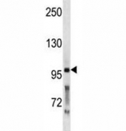 PCSK5 antibody western blot analysis in WiDr lysate.