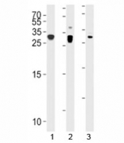 p27Kip1 antibody western blot analysis in 1) A431, 2) HeLa, and 3) mouse C2C12 lysate. Predicted molecular weight ~27kDa.