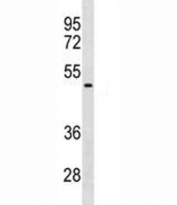NEU1 antibody western blot analysis in HepG2 lysate. Predicted molecular weight ~45 kDa.