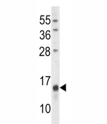 Osteocalcin antibody western blot analysis in U251 lysate. Predicted molecular weight: ~12 kDa~