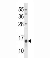 Osteocalcin antibody western blot analysis in U251 lysate.  Predicted molecular weight: ~12 kDa