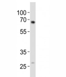 Western blot analysis of lysate from mouse kidney tissue using ALK3 antibody diluted at 1:1000.