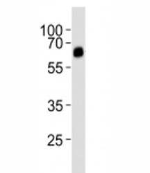 Western blot analysis of lysate from rat uterus tissue lysate using ALK3 antibody diluted at 1:1000.