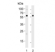 Western blot testing of 1) human HEK293 and 2) mouse NIH-3T3 cell lysate with ALK3 antibody. Predicted molecular weight ~60 kDa. 