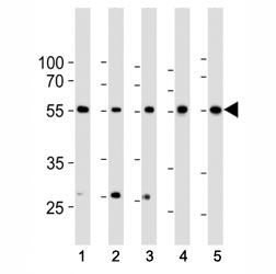 Western blot analysis of lysate from 1) HeLa, 2) K562, 3) MCF-7 cell line, 4) human liver and 5) mouse liver tissue lysate using BMPR1A antibody at 1:1000. Predicted molecular weight ~60 kDa.~