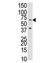 Western blot analysis of BMPR1B antibody and NCI-H460 cell lysate. Predicted molecular weight 55~60 kDa.